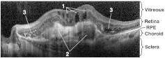 Fig. 13