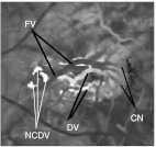 Fig. 11