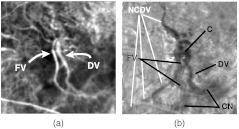 Fig. 15