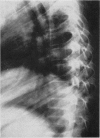 74