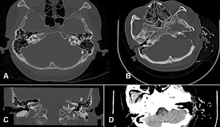 Fig. 1