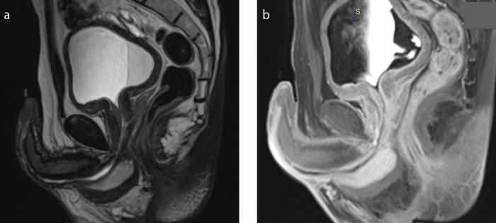 Figure 4. a, b