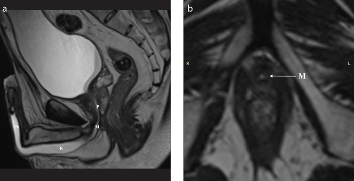 Figure 2. a, b