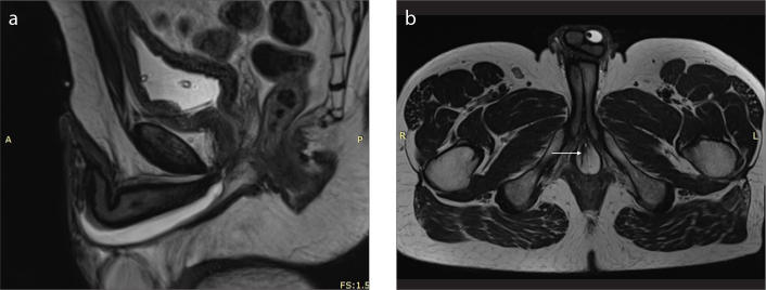 Figure 5. a, b