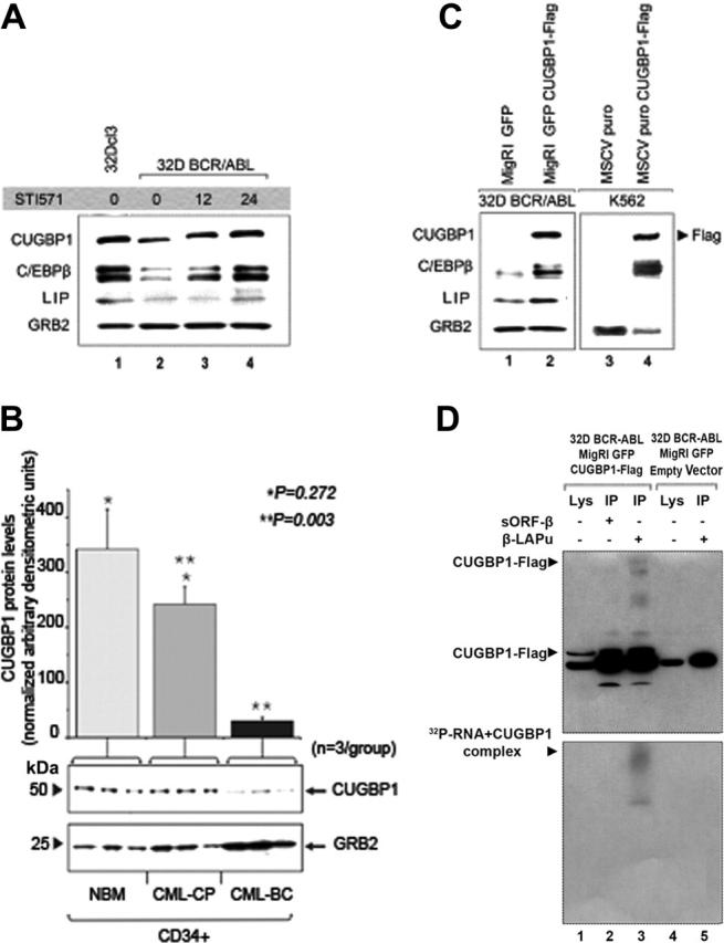 Inducible activation of CEBPB, a gene negatively regulated by BCR/ABL ...