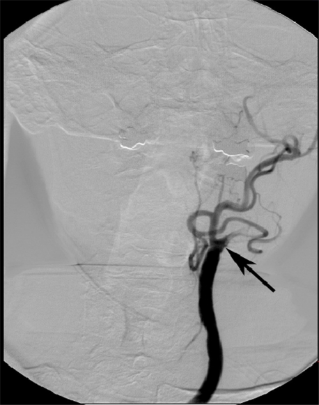 Figure 16.