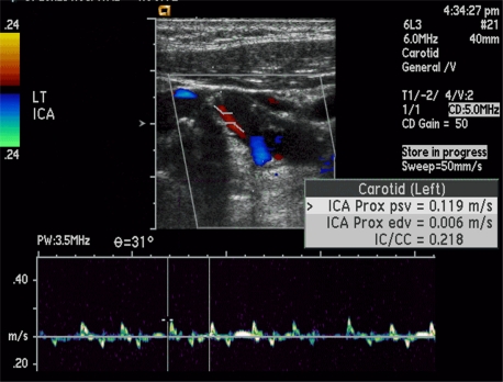 Figure 14.
