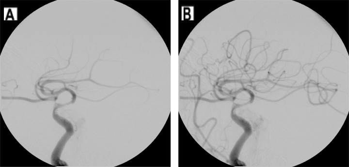 Figure 17.