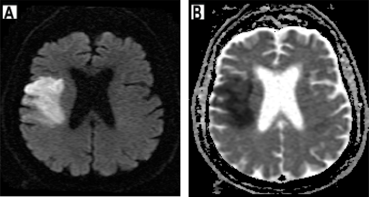 Figure 12.