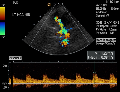 Figure 13.