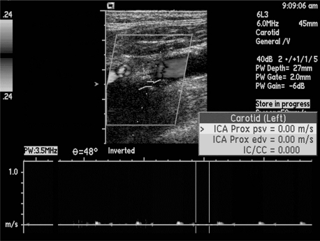 Figure 15.