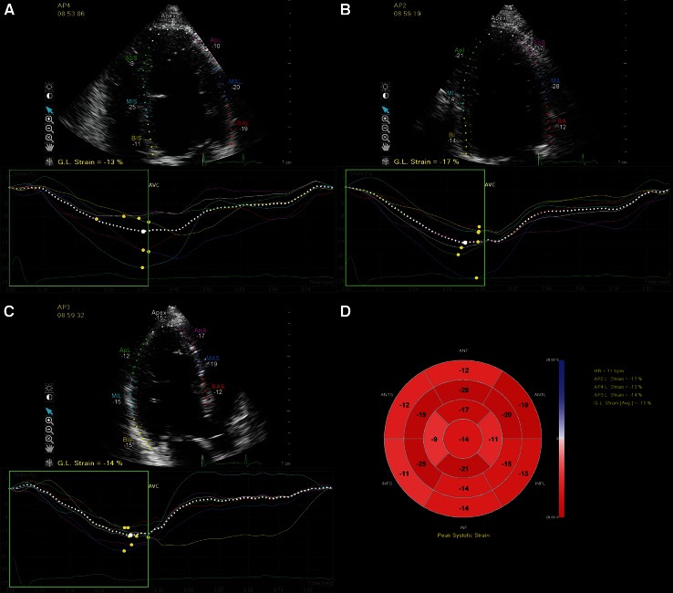 Fig. 1