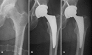 Fig. 3A–C