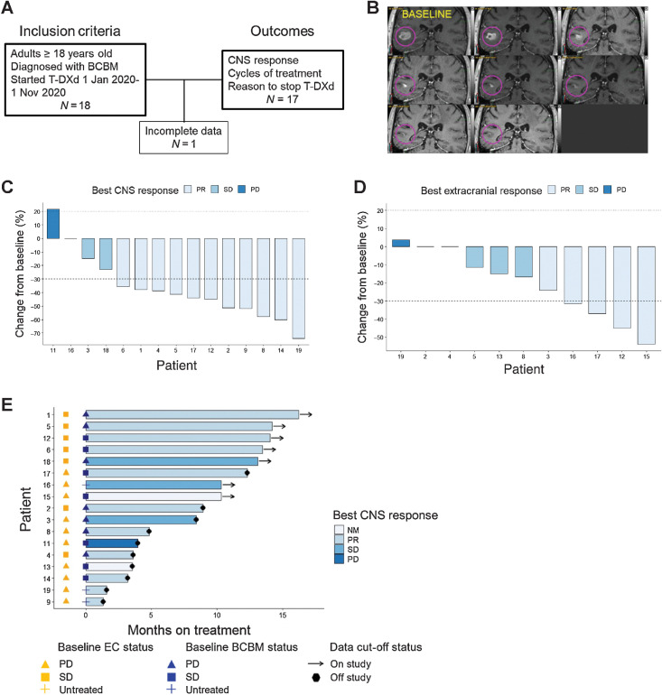 Figure 2. Response to T-DXd in patients with BCBMs. A, Study scheme showing study entry criteria and reported outcomes. B, Contrast-enhanced brain MRIs of patient response to T-DXd. Baseline image shown at top left and images arranged in serpentine succession at restaging intervals show evidence of durable response. The lesion shown had not received prior stereotactic radiosurgery and the patient had progressed through prior treatment with T-DM1, neratinib, and tucatinib. C, Best CNS response to T-DXd. Waterfall plot of best CNS response in patients with measurable disease (n = 15). D, Best extracranial response to T-DXd. Waterfall plot of best extracranial response in patients with measurable disease (n = 11). E, Months on treatment with T-DXd. Swimmer plot showing patient (n = 17) cycles on treatment with T-DXd by baseline extracranial (EC) disease (gold shapes) and BCBM status (navy blue shapes). A total of 10 of 17 (59%) had progressive or untreated CNS disease at baseline. NM = nonmeasurable, PR = partial response, SD = stable disease, PD = progressive disease.