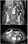 Fig. 1