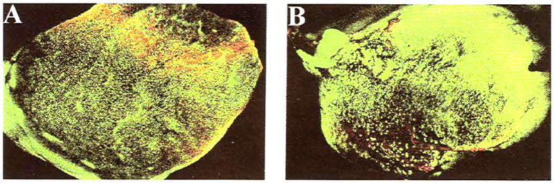 Fig 11