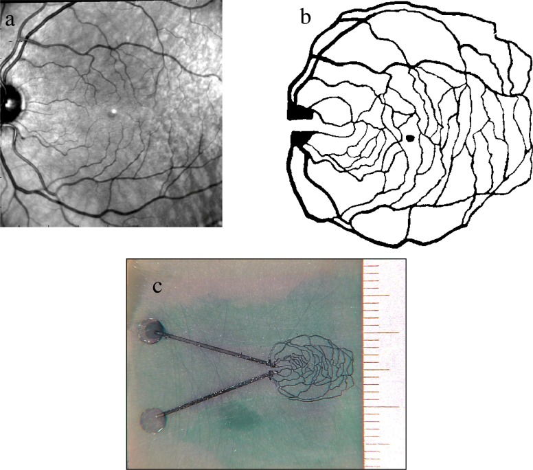 Fig. 16