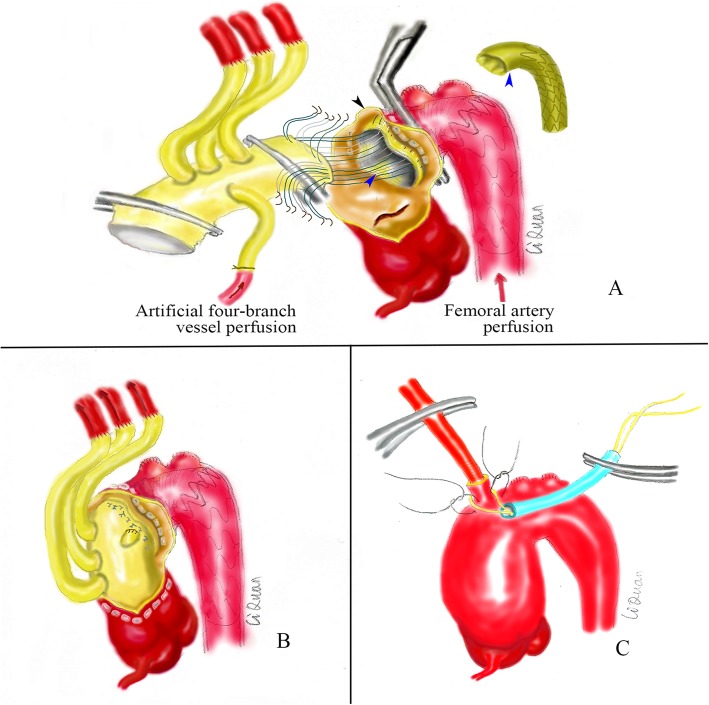 Fig. 3