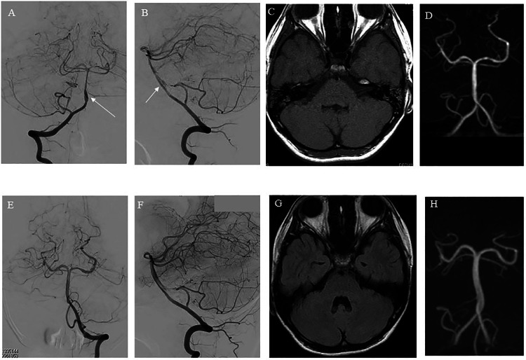 Fig 4