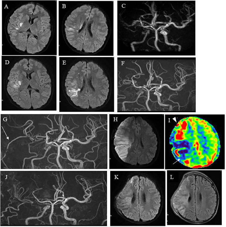 Fig 2