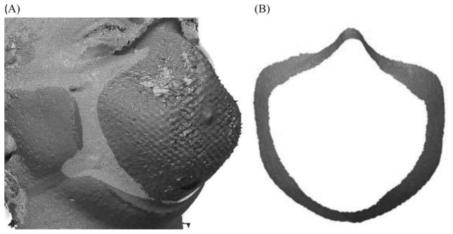 FIGURE 3