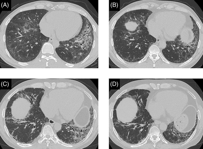 FIGURE 1