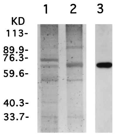 FIG. 1