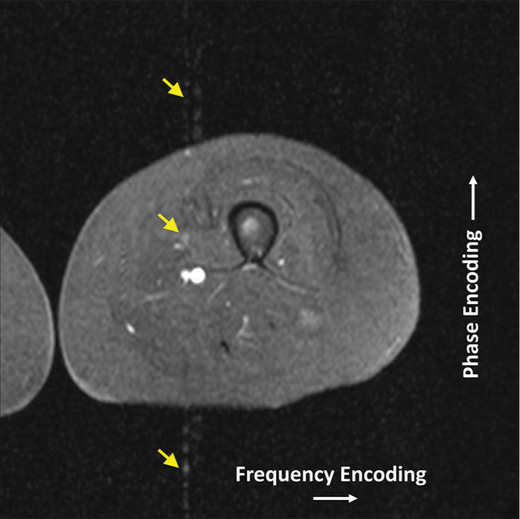 Figure 9: