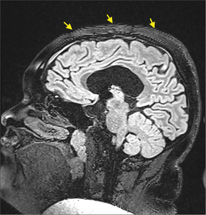 Figure 10: