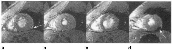 FIG. 7