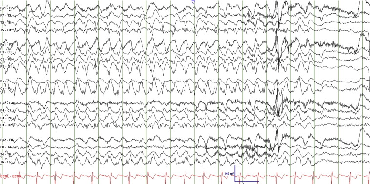 Fig. 4