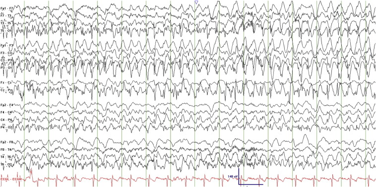 Fig. 3