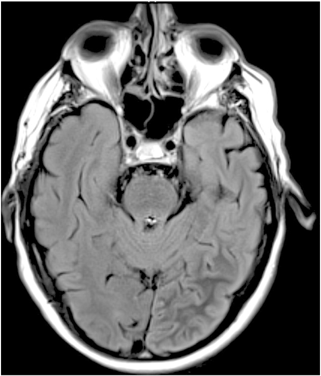 Fig. 1