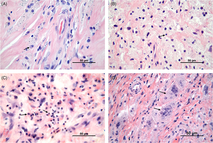 FIGURE 1