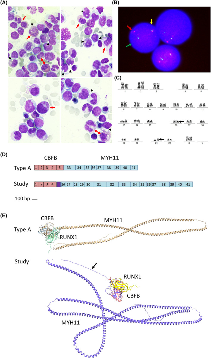 FIGURE 1