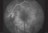 Figure 19