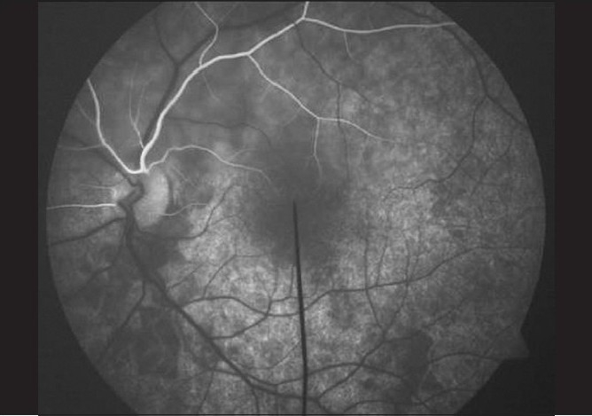 Figure 19