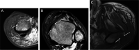 Fig. 17