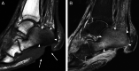Fig. 15