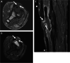 Fig. 14