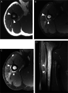 Fig. 12