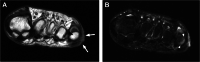 Fig. 16