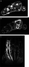 Fig. 11