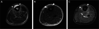 Fig. 13