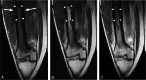 Fig. 18
