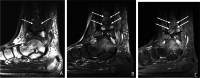 Fig. 19