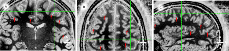 Fig. 6.