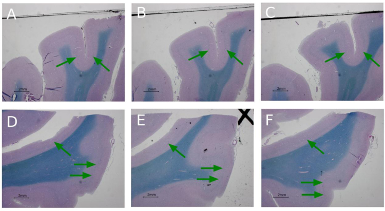 Fig. 12