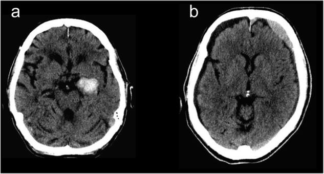 Fig. 5