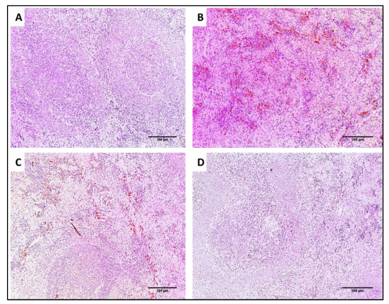 Figure 18